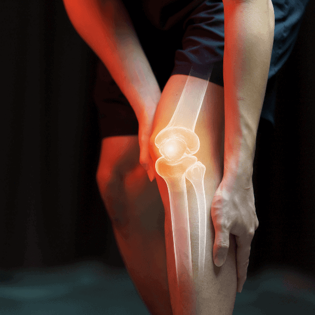 A man's knee with a x-ray type overlay of his knee joint representing body health by consuming bone broth